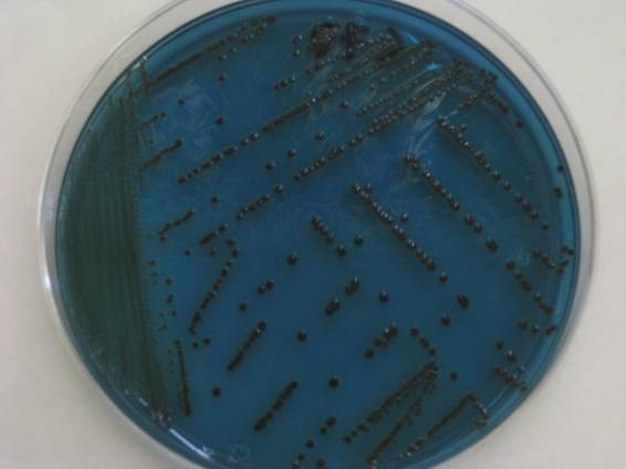 Figura 1. Crecimiento de colonias de Salmonella presuntivas en agar Hektoen.
