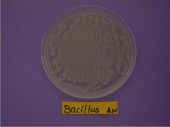 Figura 2. Aislado de Bacillus.